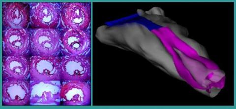 renal scan