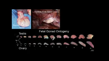 fetal gonad ontogeny