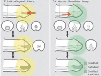 ectodermal ingrowth theory and endodermal differentiation theory