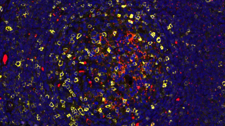 Tissue Cells to HIV