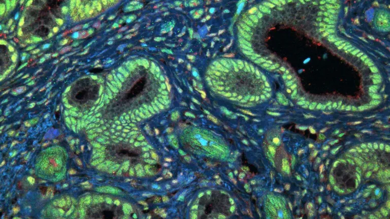 UCSF Press Release_Growth Protein, MYC-and-RBM42-merge