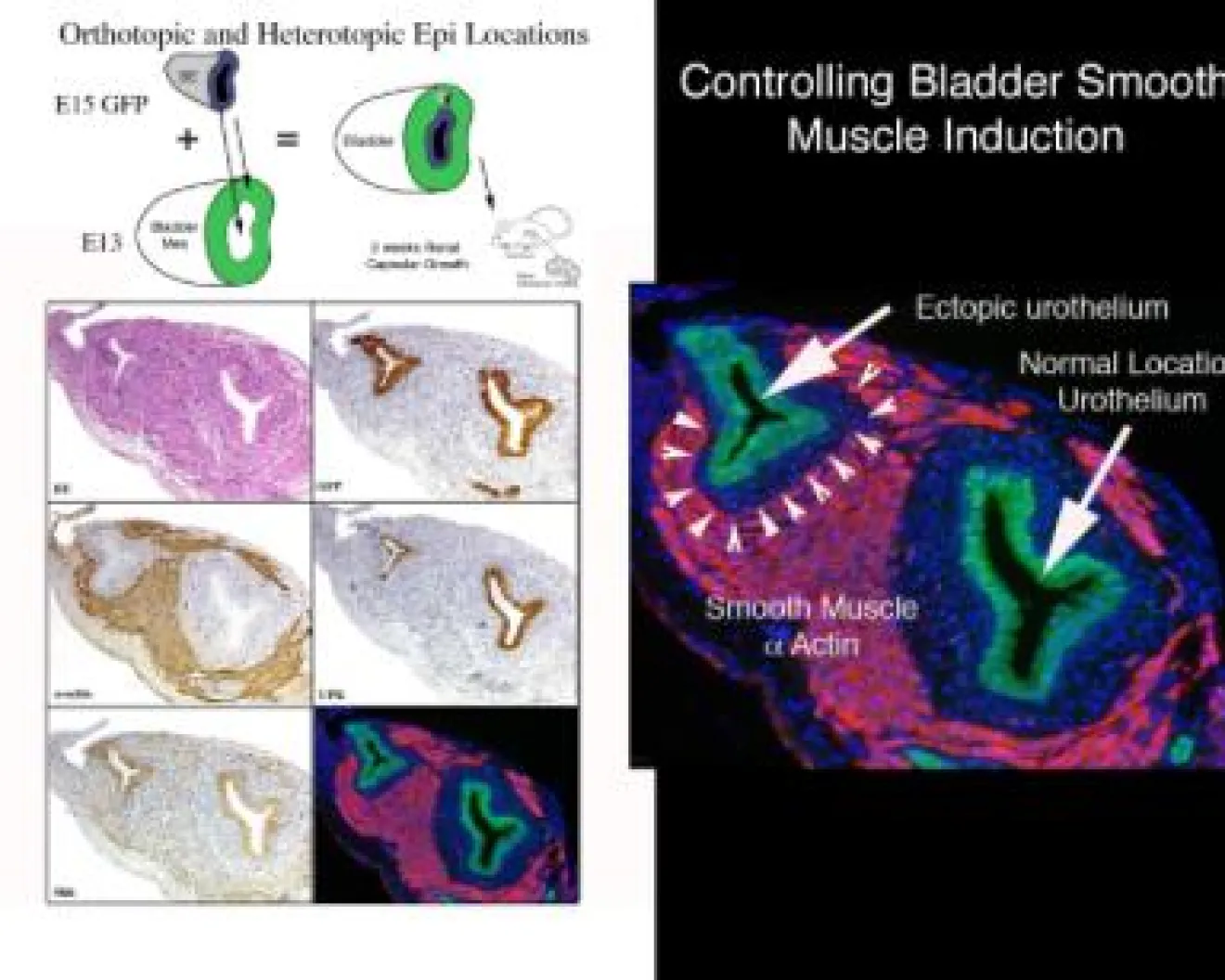 controlling bladder smooth muscle induction