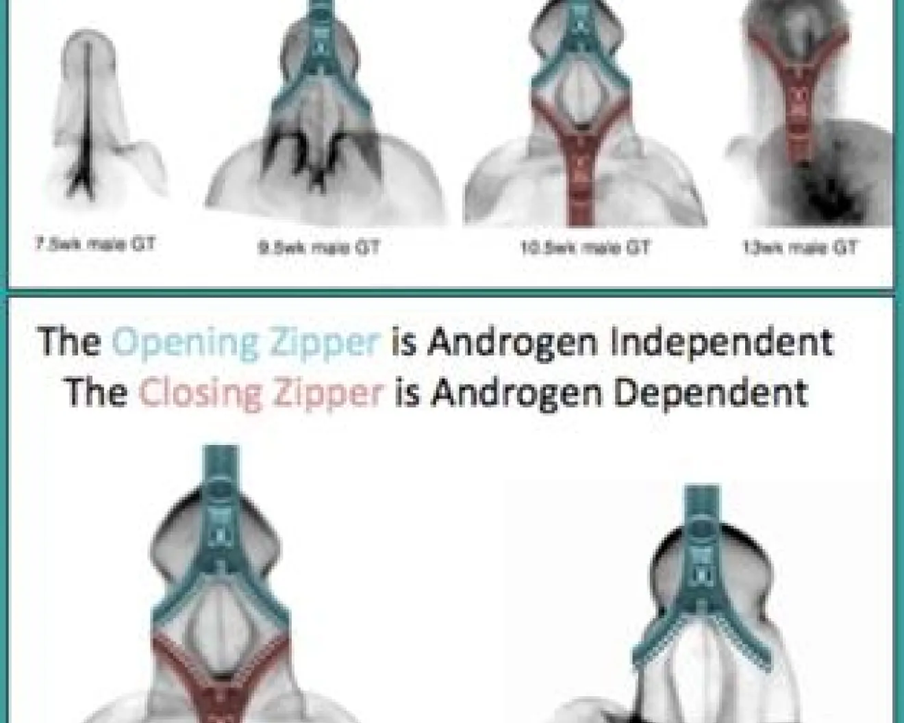 distal opening and proximal closing zippers