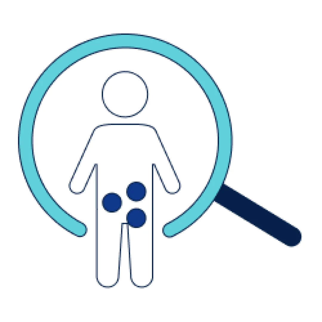 Prostate Cancer Diagnosis