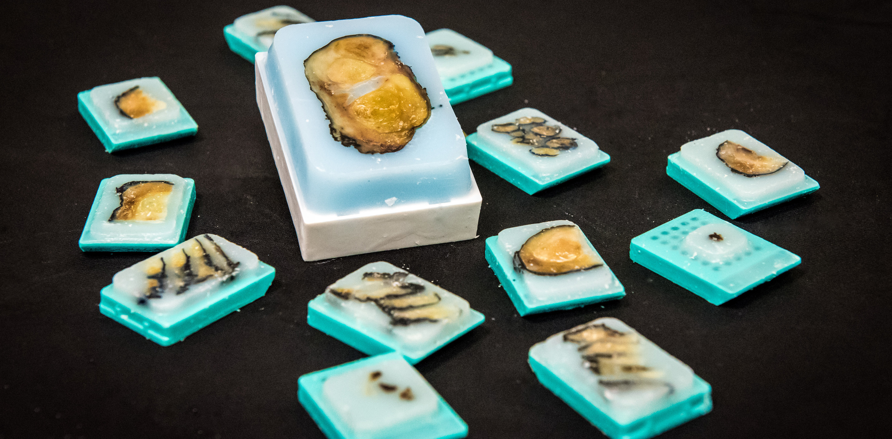 Formalin-Fixed Paraffin-Embedded Blocks of Prostate Specimens Formalin-Fixed Paraffin-Embedded Blocks of Prostate Specimens